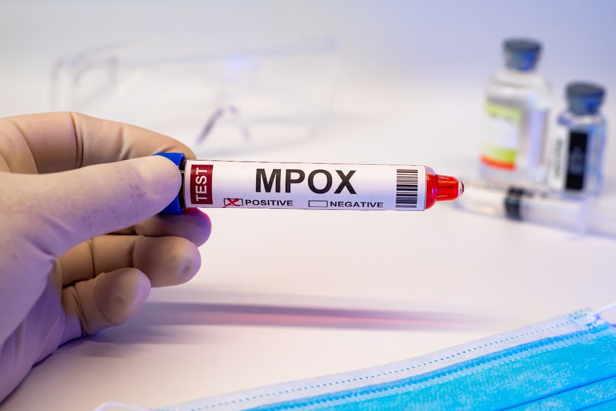 WHO Issues Emergency Alert as Mpox Resurgence Strikes DRC