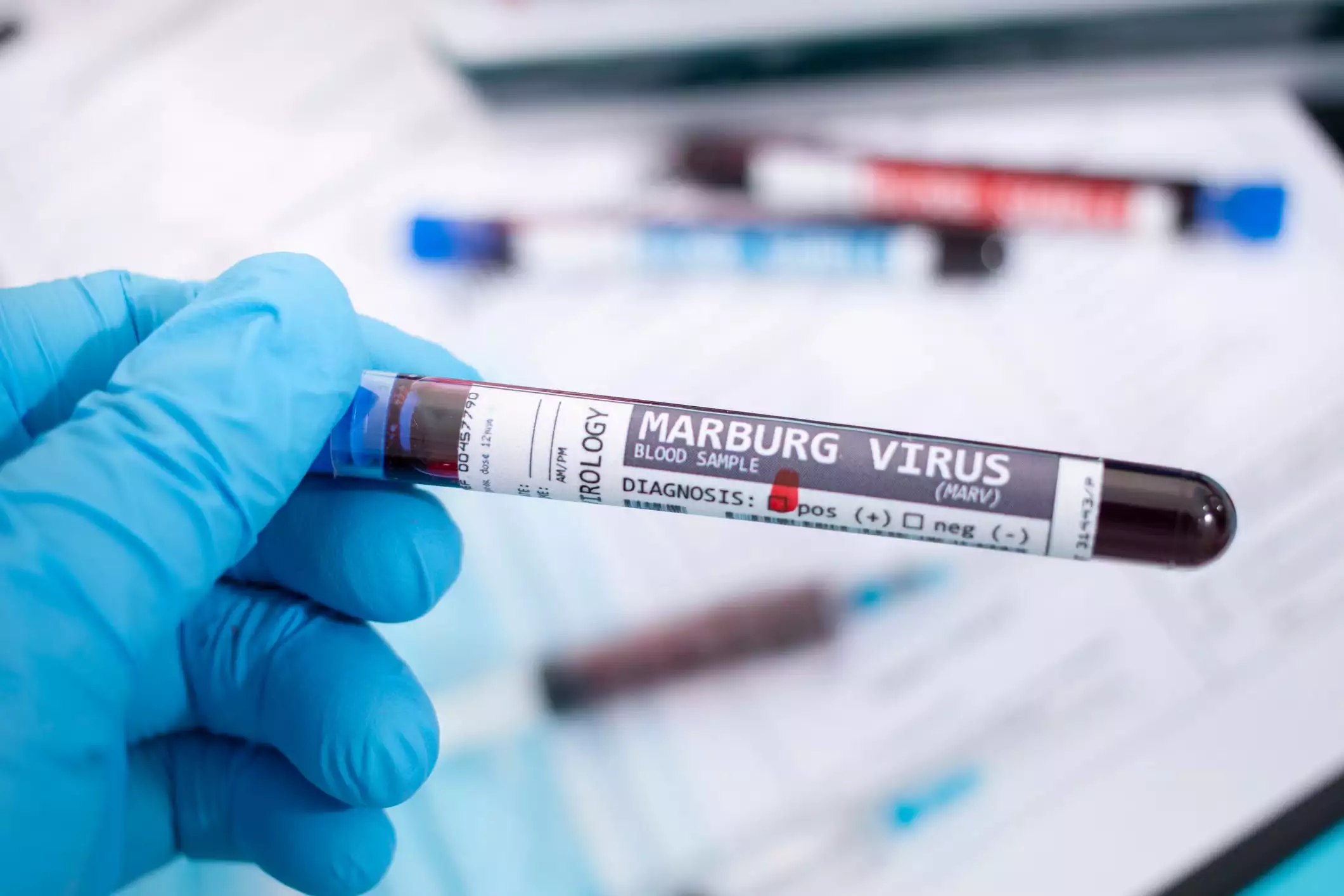 Rwanda to Declare Marburg Virus Outbreak Over